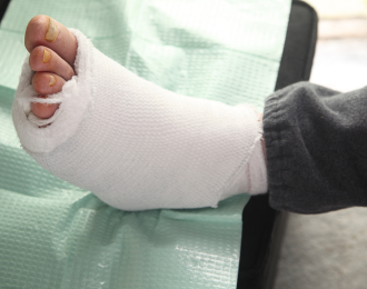 injured foot of an employee covered with bandage